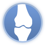 Osteoarthritis Stem Cell Therapy